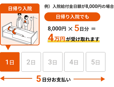 日帰り入院　入院給付金日額8,000円の場合：5日分の4万円をお支払い